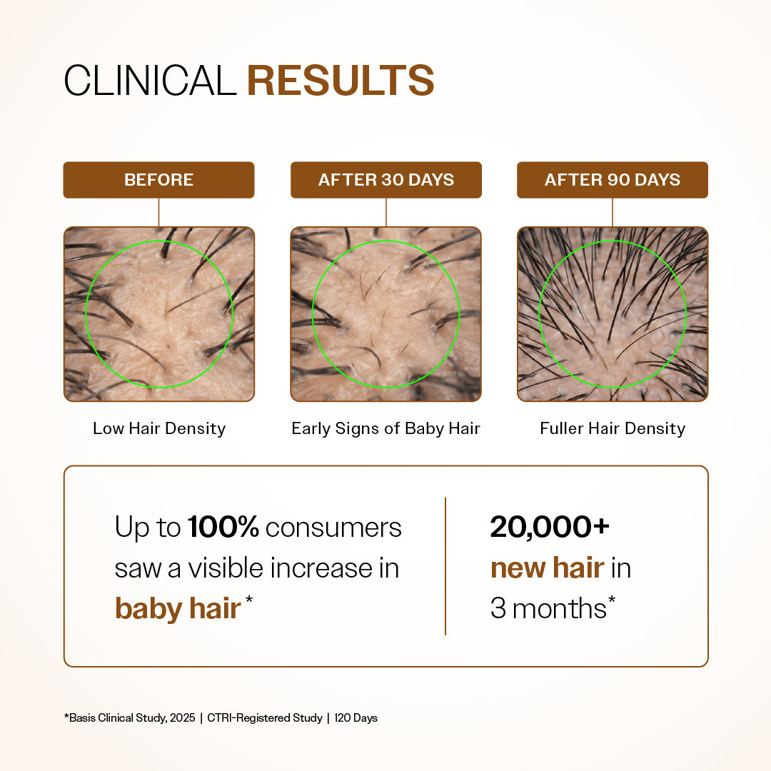 Bare Anatomy Advanced Hair Growth Serum – 30 ml