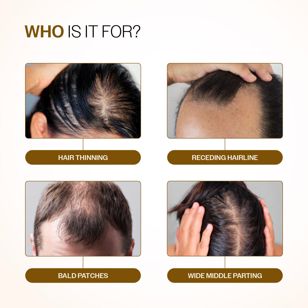 Bare Anatomy Hair Growth Serum Roll-On – 25 ml