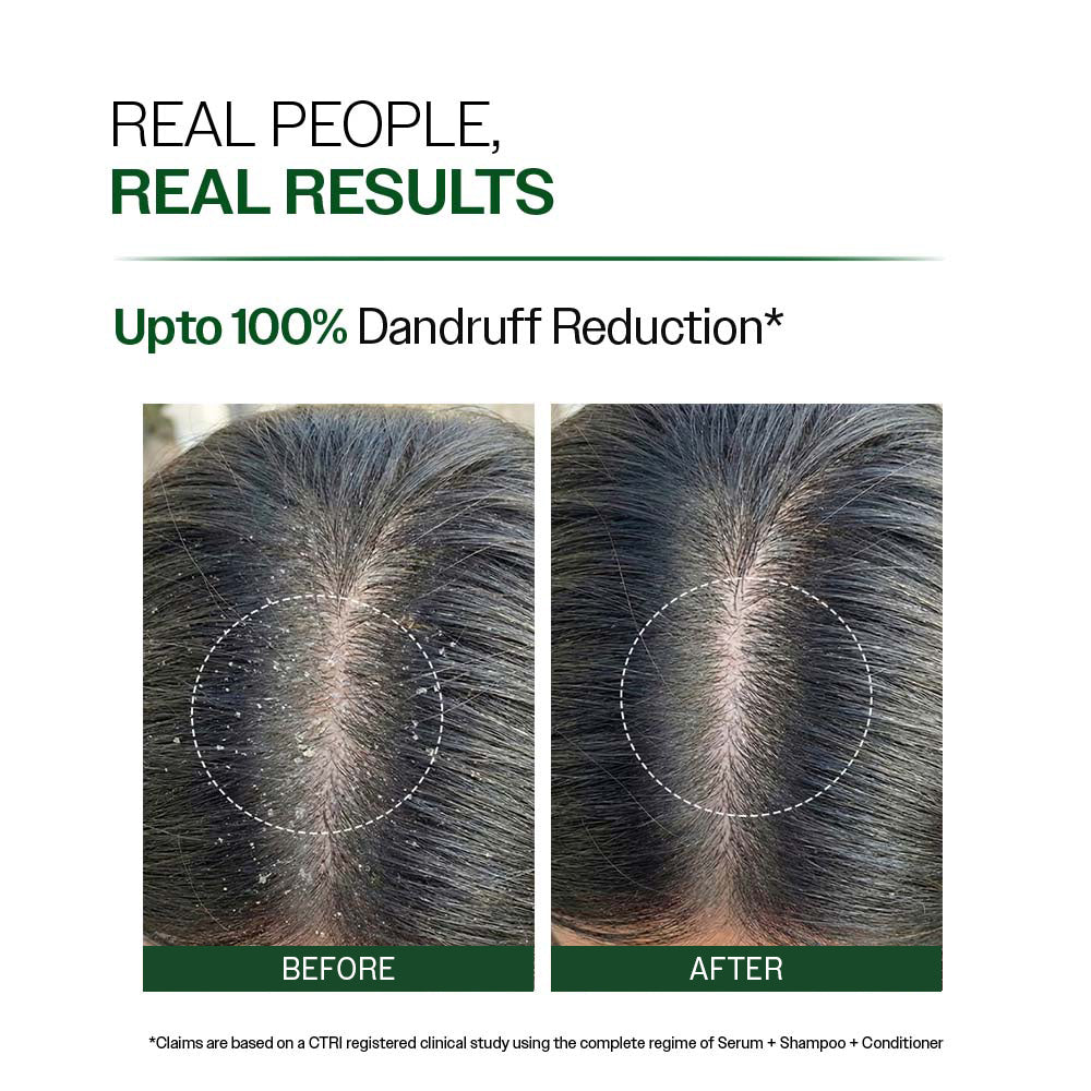 Bare Anatomy Anti-Dandruff Shampoo – 250 ml
