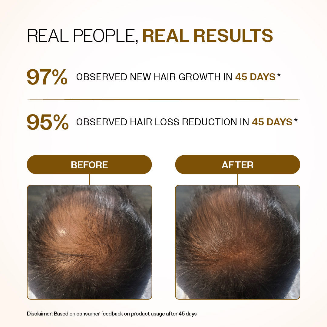 Bare Anatomy Hair Growth Serum Roll-On – 25 ml