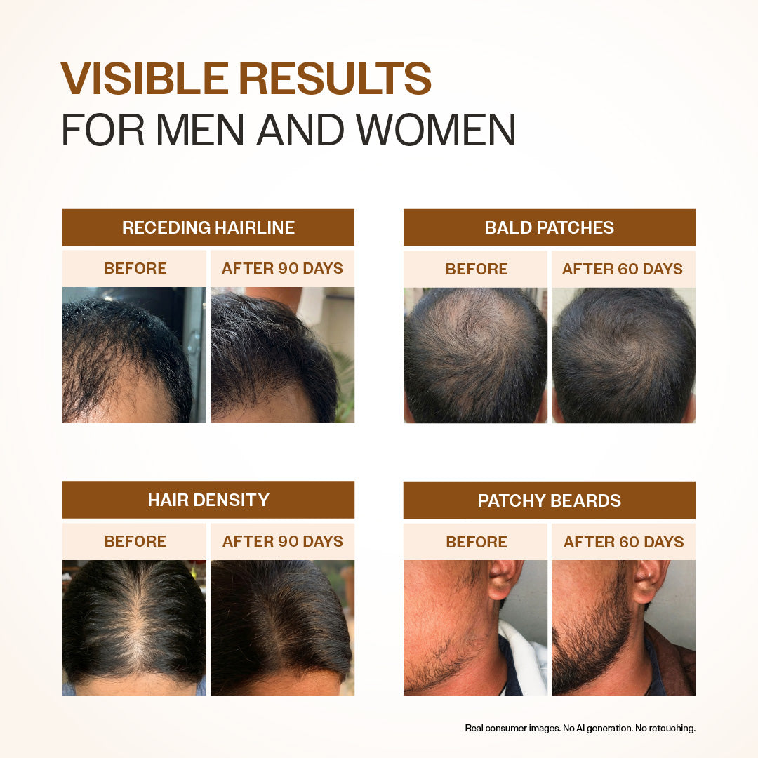 Bare Anatomy Advanced Hair Growth Serum – 30 ml
